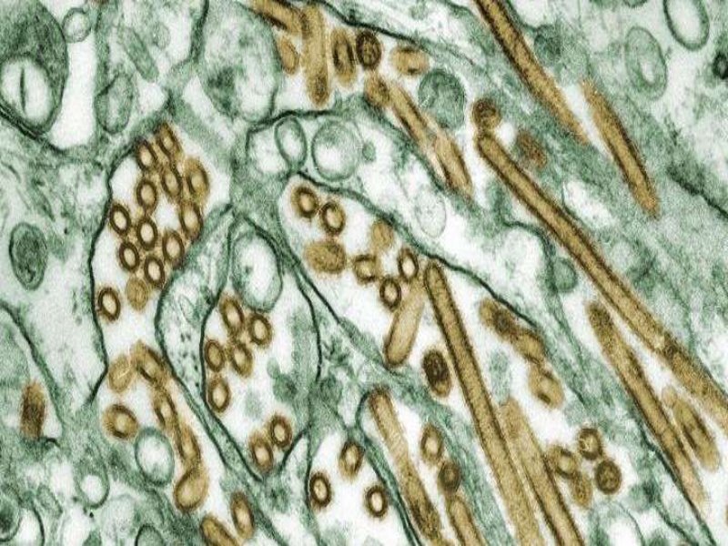 U.S. child tests positive for bird flu